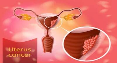 शरीर में नजर आ रहे हैं ये लक्षण तो करवाएं Uterine Cancer की जांच, समय रहते पहचान लेने से टल सकता है बड़ा खतरा
