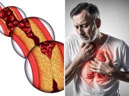 हाई कोलेस्ट्रॉल बन सकता है हार्ट अटैक की वजह, इन चीजों से हमेशा के लिए बना लें दूरी