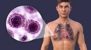 सिर्फ फेफड़े ही नहीं शरीर के इन अंगों को भी खराब करता है प्रदूषण, कैसे करें बचाव?